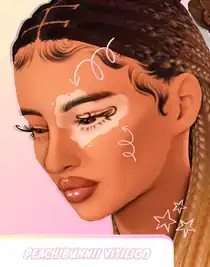 Peachi Vitiligo V1