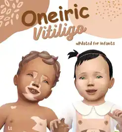 Oneiric vitiligo by melichryses Updated for infants 