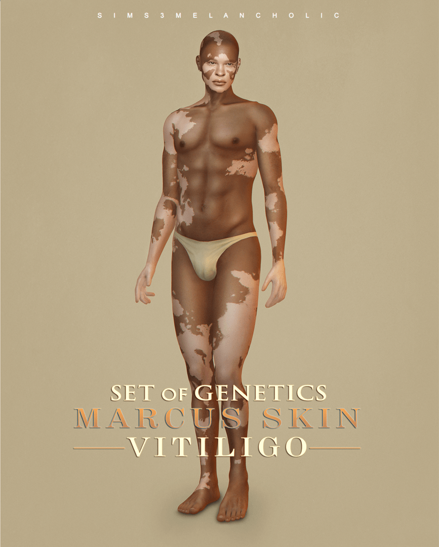 Marcus Skin VITILIGO