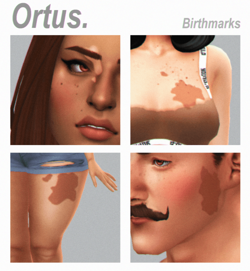 Face and Body Birthmarks Skin Details for Male and Female All Ages [MM]