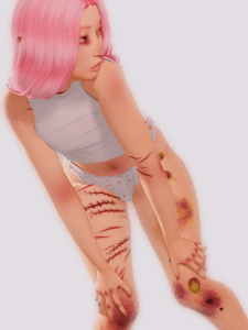 cuts and bruises skin details