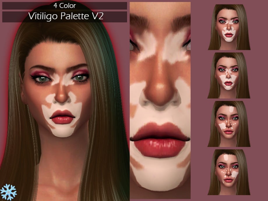 LMCS Vitiligo Palette V2
