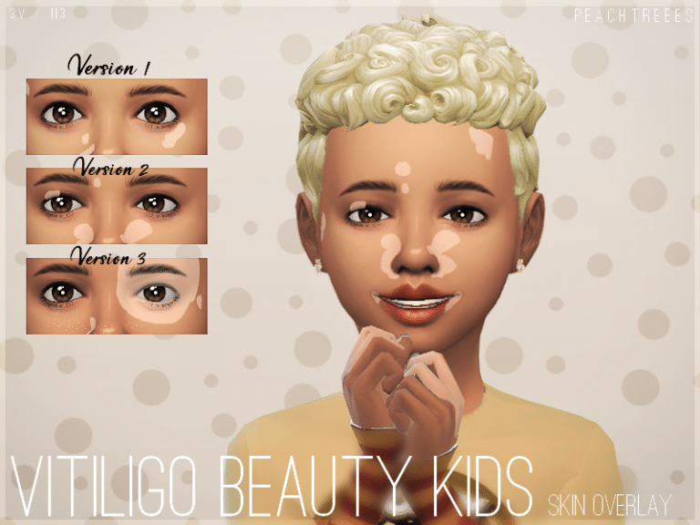 Vitiligo Beauty Skin Overlay Kids N3