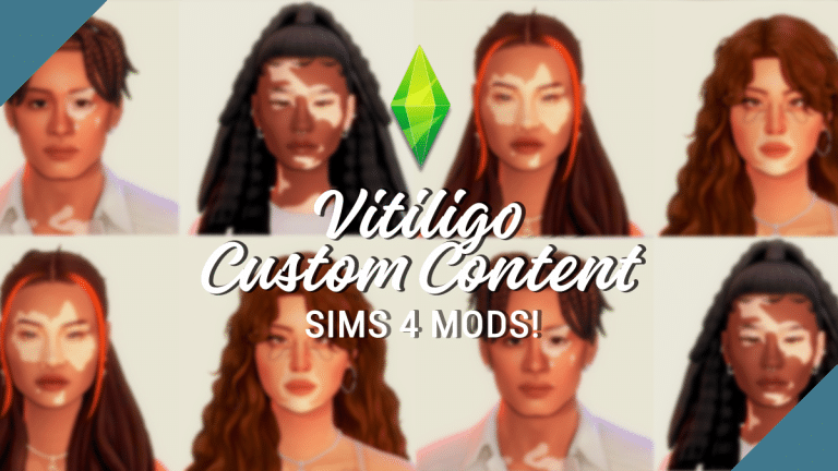 The Best Vitiligo CC For Beautifully Unique Sims