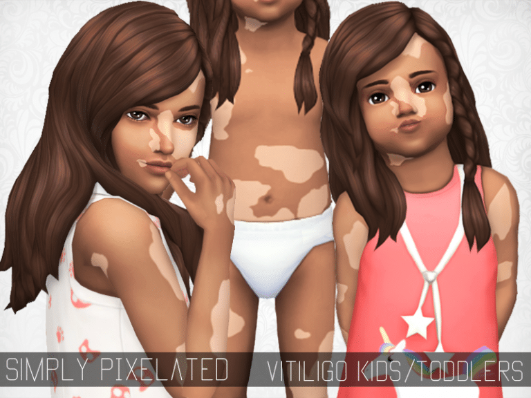Vitiligo Overlay - Child/Toddler