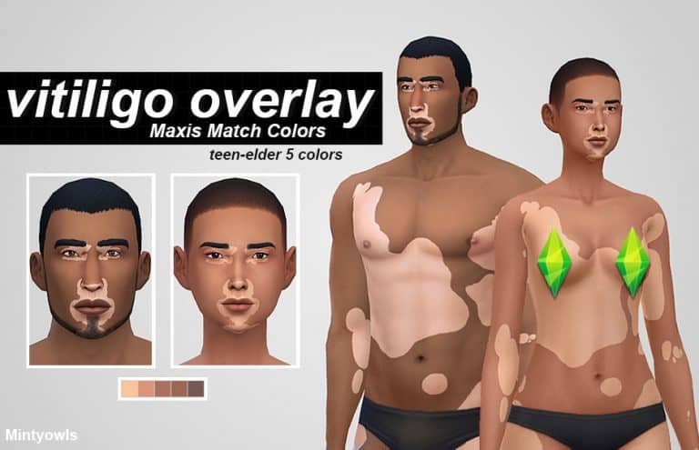 Vitiligo Overlay Maxis Match Colors