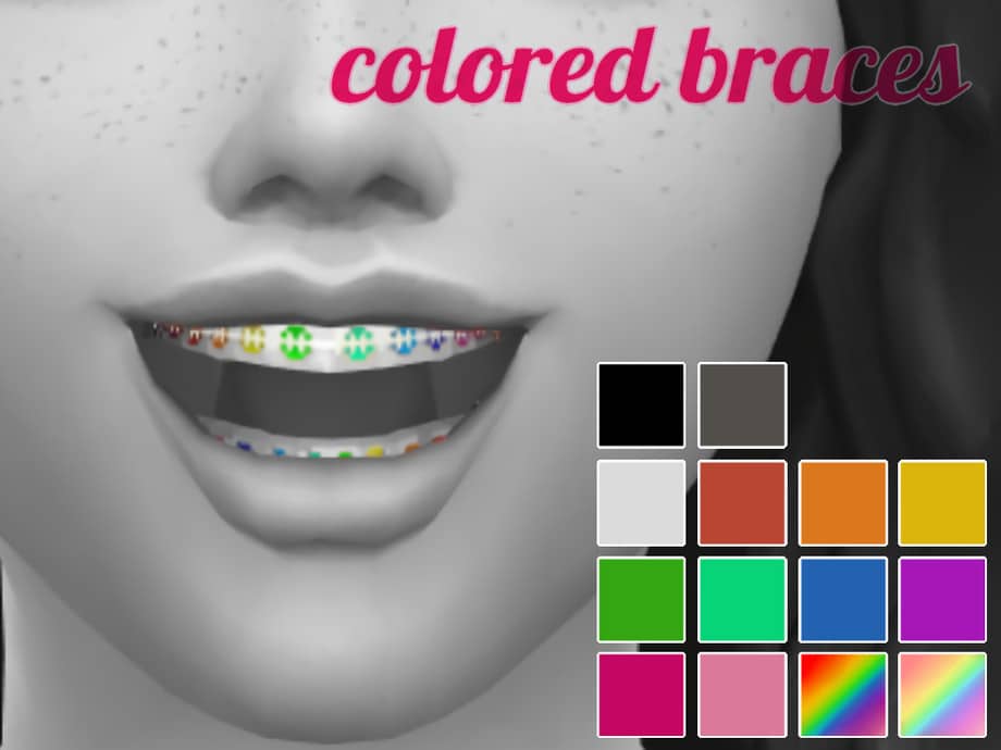 Colored Braces