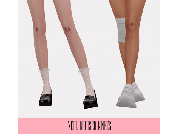 237648 bruised knees sims4 featured image