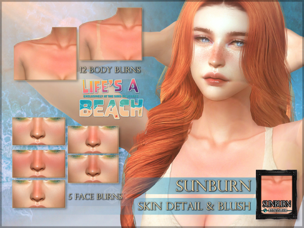 330100 sunburn detail set sims4 featured image